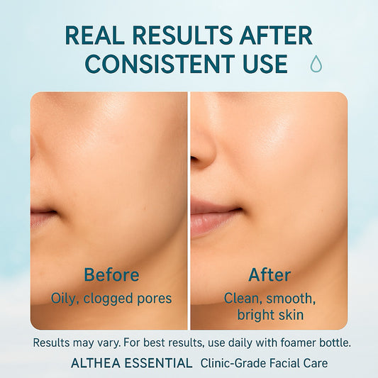 Salicylic Facial Foam Cleanser – 1 Liter Refill | Sulfate-Free Deep Pore Cleanse for Acne-Prone Skin | Althea Essential